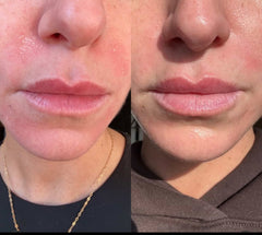 Siv Biome Balancing Serum